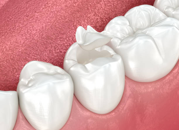 Best Dental Exams and Cleanings  in Roscommon, MI